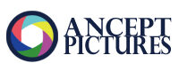 アンセプトピクチャーズ